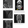 Atlas of Cone Beam Computed Tomography 2022