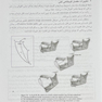 خلاصه تست پروتز کامل زارب denolix