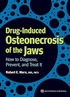 عکس Drug-Induced Osteonecrosis of the Jaws