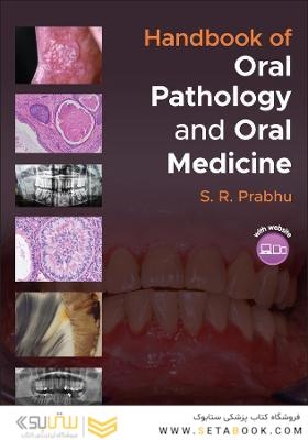 Handbook of Oral Pathology and Oral Medicine