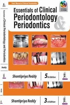 عکس Essentials of Clinical Periodontology - Periodontics