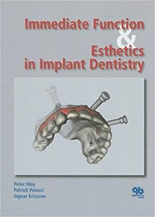 عکس Immediate Function and Esthetic in Implant Dentistry