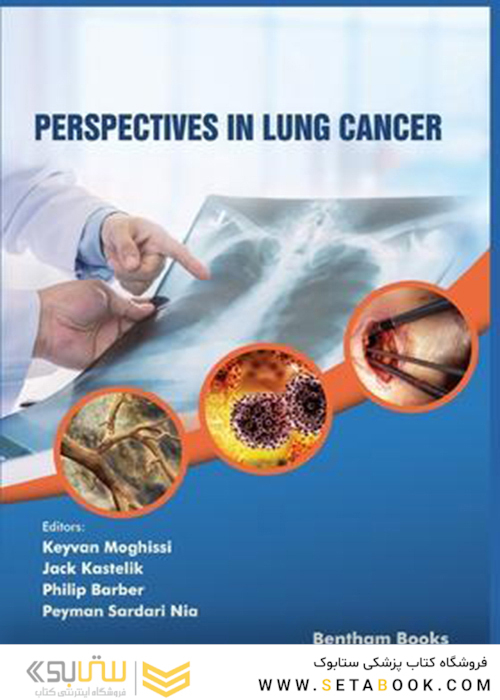 Perspectives in Lung Cancer 2020