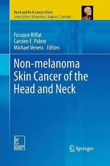 عکس Non-melanoma Skin Cancer of the Head and Neck