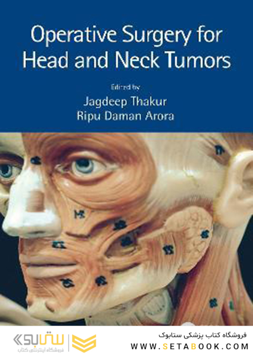Operative Surgery for Head and Neck Tumors