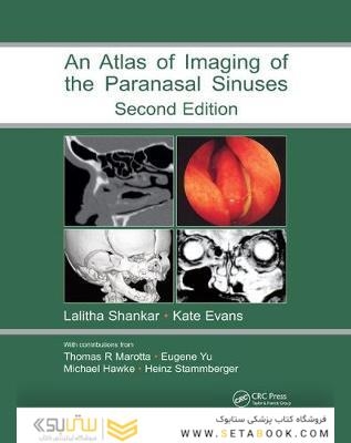 Atlas of Imaging of the Paranasal Sinuses, Second Edition