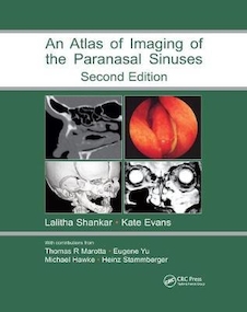 عکس Atlas of Imaging of the Paranasal Sinuses, Second Edition