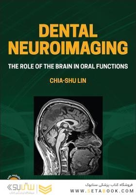 Dental Neuroimaging