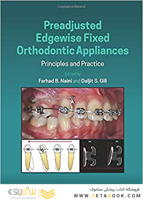 Preadjusted Edgewise Fixed Orthodontic Appliances: Principles and Practice 1st Edicion