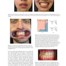 Preadjusted Edgewise Fixed Orthodontic Appliances: Principles and Practice 1st Edicion