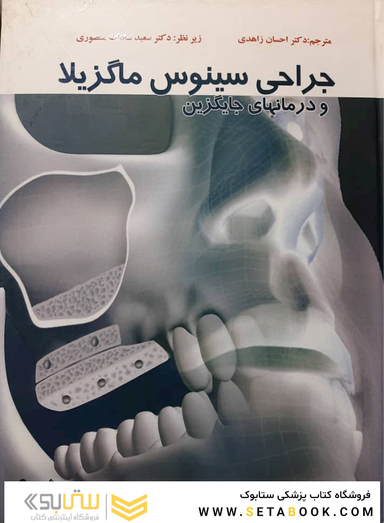 درمان سینوس ماگزیلا و درمان های جایگزین