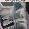 درمان سینوس ماگزیلا و درمان های جایگزین