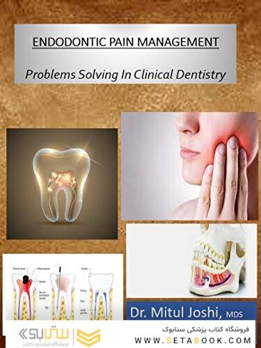 ENDODONTIC PAIN MANAGEMENT: Problems Solving In Clinical Dentistry