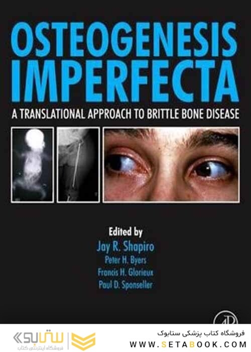 Osteogenesis Imperfecta : A Translational Approach to Brittle Bone Disease