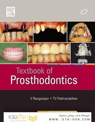 Textbook of Prosthodontics