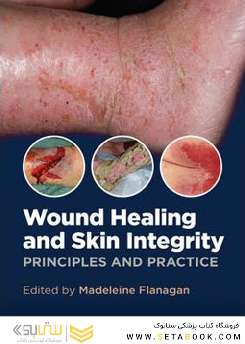 Wound Healing and Skin Integrity