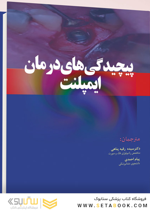پیچیدگی های درمانی ایمپلنت
