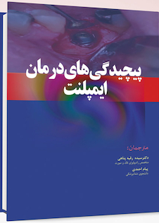 عکس پیچیدگی های درمانی ایمپلنت