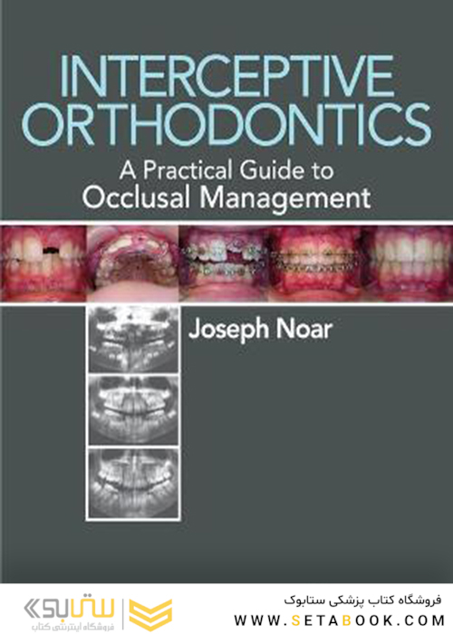 Interceptive Orthodontics : A Practical Guide to Occlusal Management