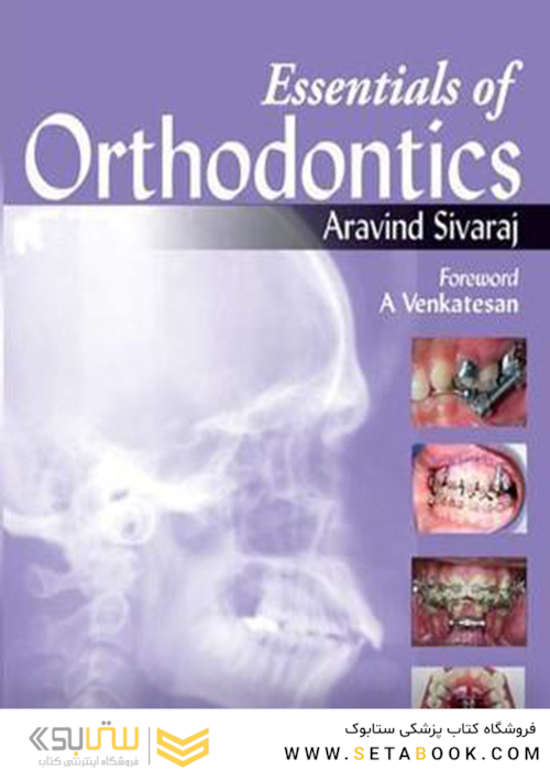Essentials of Orthodontics 2013