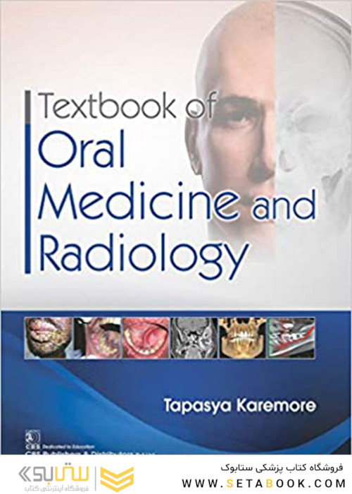 Textbook of Oral Medicine and Radiology