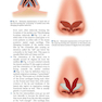 Textbook of Nasal Tip Rhinoplasty : Open Surgical Techniques