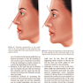 Textbook of Nasal Tip Rhinoplasty : Open Surgical Techniques