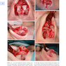 Textbook of Nasal Tip Rhinoplasty : Open Surgical Techniques