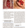 Textbook of Nasal Tip Rhinoplasty : Open Surgical Techniques