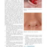 Textbook of Nasal Tip Rhinoplasty : Open Surgical Techniques