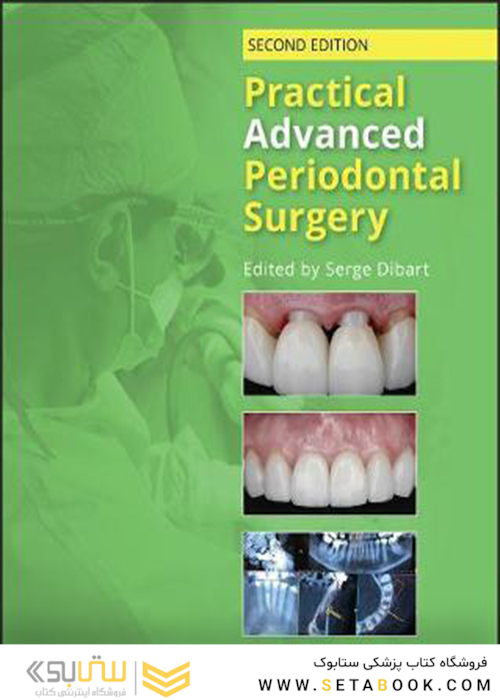 Practical Advanced Periodontal Surgery 2020