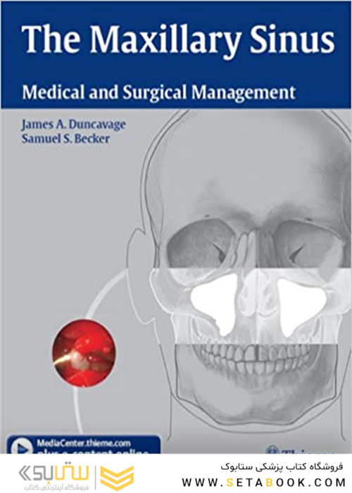 The Maxillary Sinus : Medical and Surgical Management