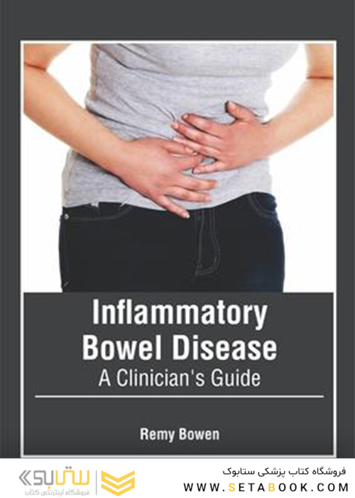 Inflammatory Bowel Disease: A Clinician