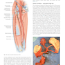 Plastic Surgery : Volume 4: Trunk and Lower Extremity 4th Edicion 2018