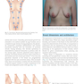 Plastic Surgery Volume 5: Breast 4th Edicion 2018