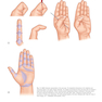Plastic Surgery Volume 6: Hand and Upper Limb 4th Edicion 2018