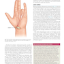 Plastic Surgery Volume 6: Hand and Upper Limb 4th Edicion 2018