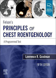 عکس Felson’s PRINCIPLES OF CHEST ROENTGENOLOGY