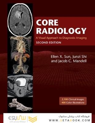 Core Radiology: A Visual Approach to Diagnostic Imaging 2nd Edicion