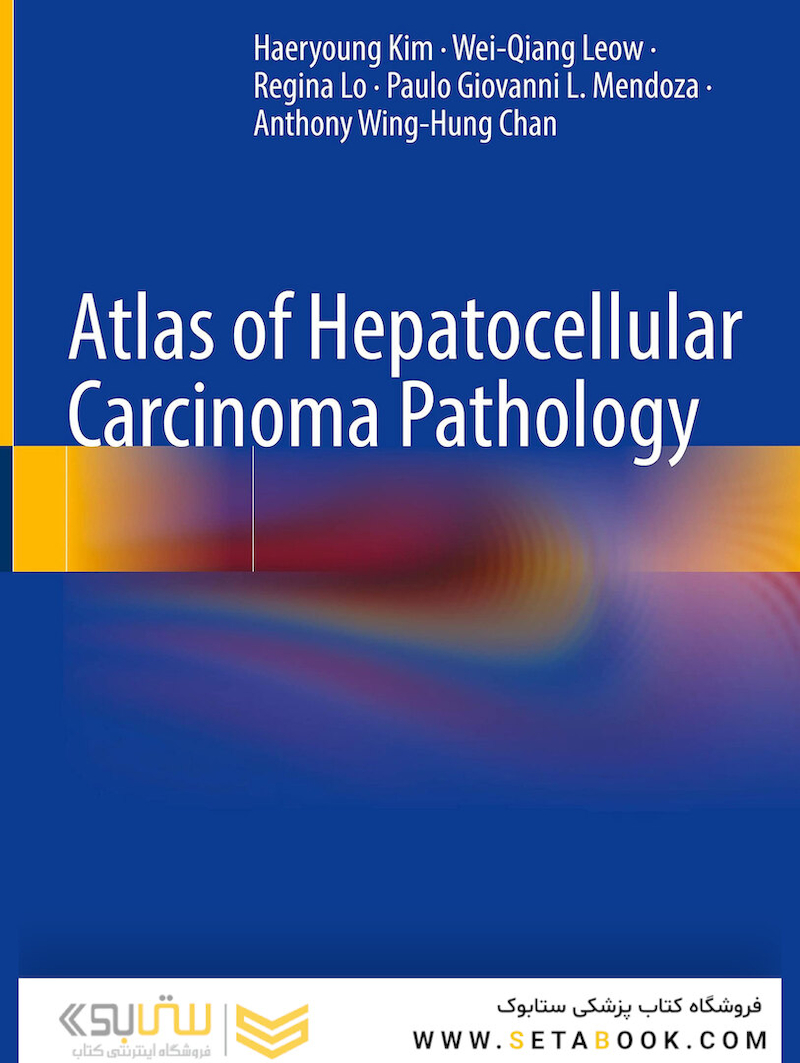 Atlas of Hepatocellular Carcinoma Pathology 1st ed. 2022 Edición