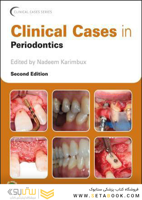 Clinical Cases in Periodontics 1st Edición, Edición Kindle
