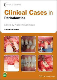 عکس Clinical Cases in Periodontics 1st Edición, Edición Kindle