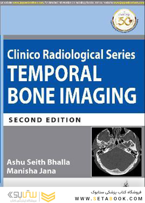 Clinico Radiological Series: Temporal Bone Imaging