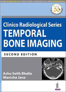 عکس Clinico Radiological Series: Temporal Bone Imaging