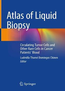 عکس Atlas of Liquid Biopsy: Circulating Tumor Cells and Other Rare Cells in Cancer Patients’ Blood 1st ed. 2021 Edición