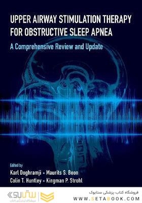 Upper Airway Stimulation Therapy for Obstructive Sleep Apnea: Medical, Surgical, and Technical Aspects 1st Edición