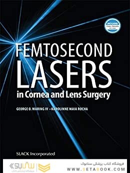 Femtosecond Lasers in Cornea and Lens Surgery 1st Edición