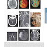 HARRISONS PRINCIPLES OF INTERNAL MEDICINE Part Neurologic Disorders