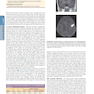 HARRISONS PRINCIPLES OF INTERNAL MEDICINE Part Neurologic Disorders