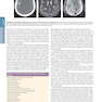 HARRISONS PRINCIPLES OF INTERNAL MEDICINE Part Neurologic Disorders